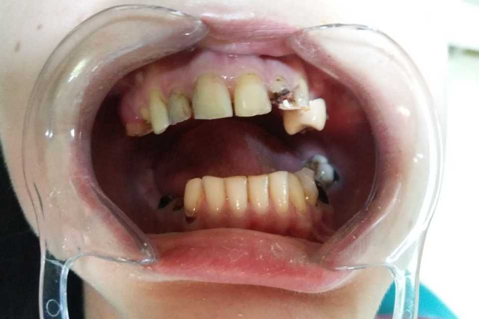 Foto 34-1