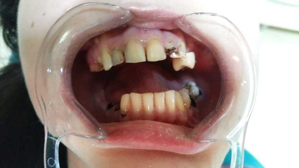Foto 34-1