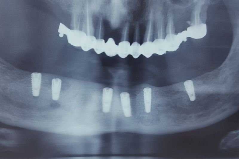 Foto 36-1