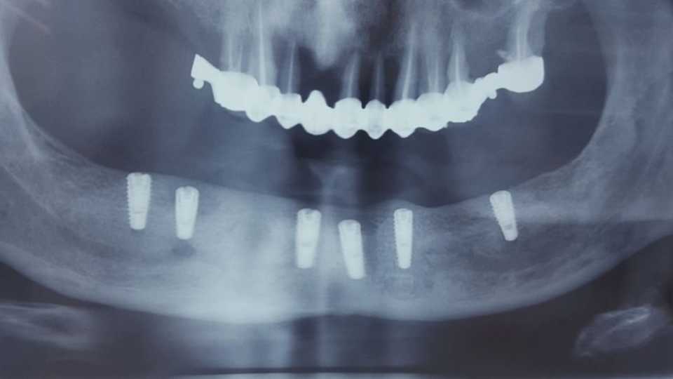 Foto 36-1