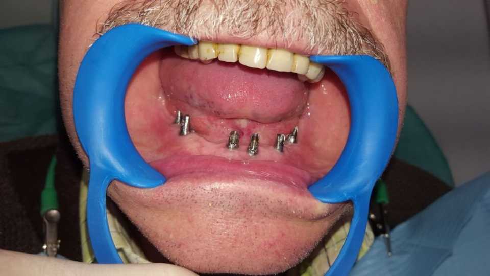 Foto 36-2