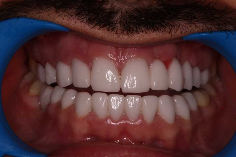 Foto 39-1