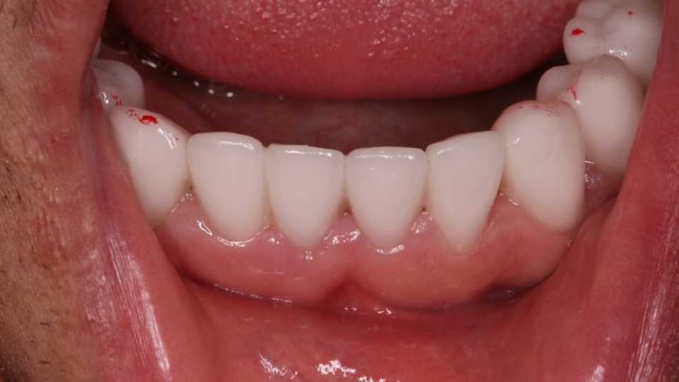 Foto 39-2