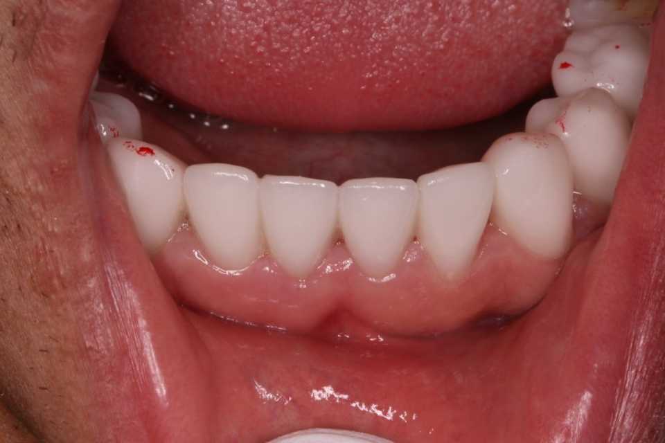 Foto 39-2