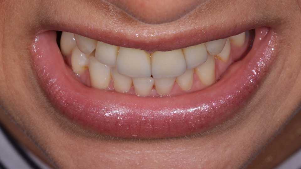 Foto 40-6