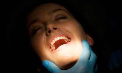 Ce este tartrul dentar, de ce apare și cum scăpăm de el