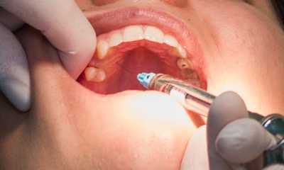 Măseaua umflată – ce este de făcut?