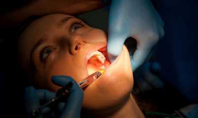 Mituri și adevăruri despre anestezia dentară