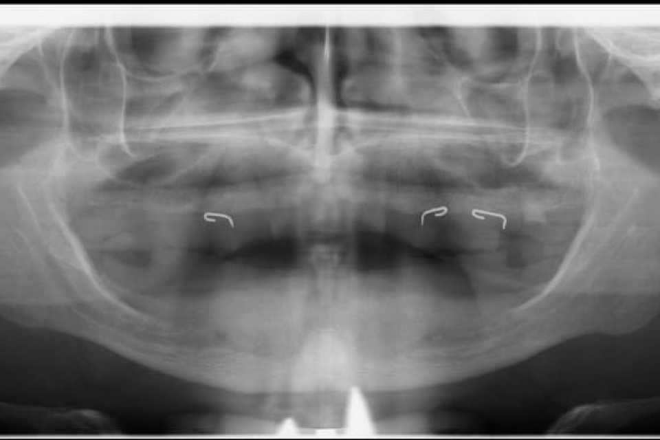 lucrari-fixe-cimentate-ceramica-7