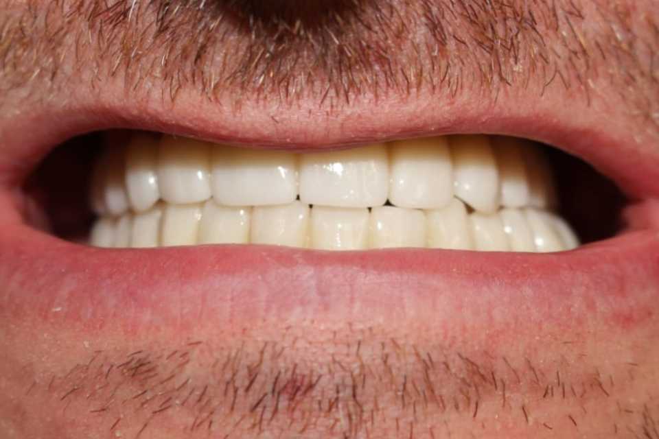 lucrari-fixe-cimentate-ceramica-3