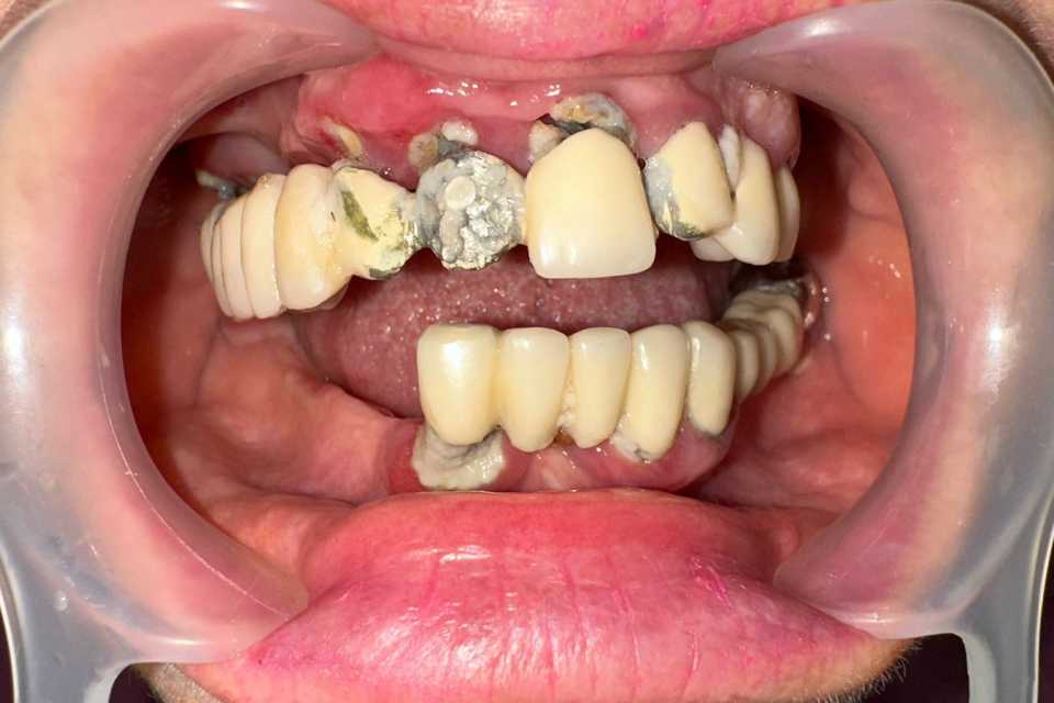 pre