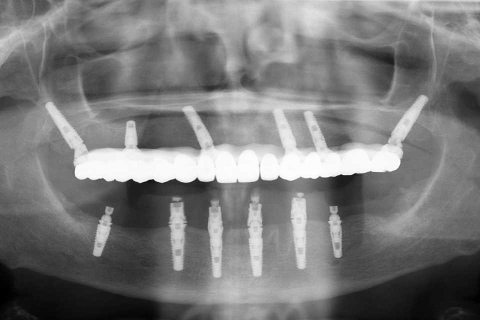 radiografie