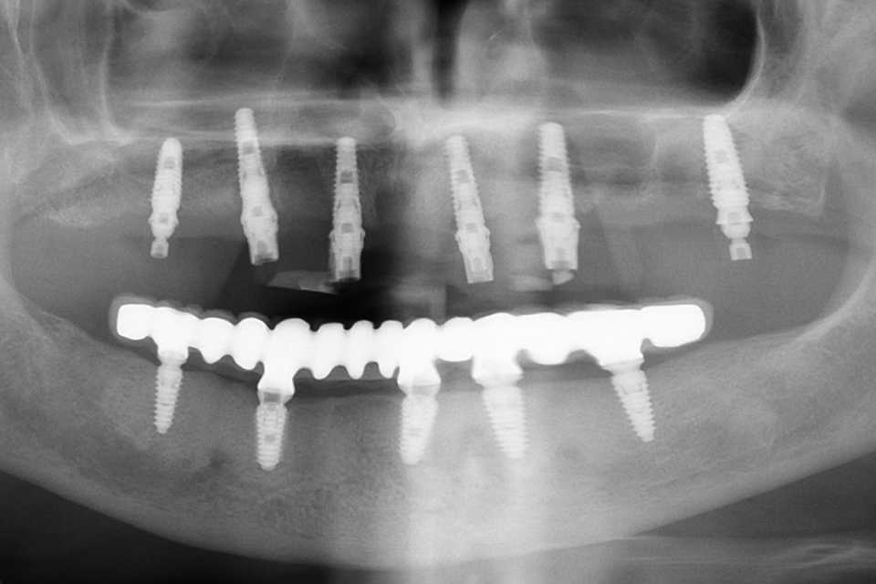 radiografie
