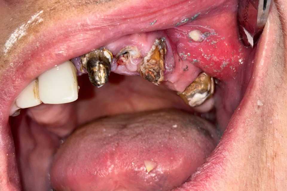 pre